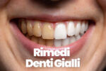Svelati i Segreti per Sbiancare i Denti Naturalmente: Sorriso Radiante a Portata di Rimedio